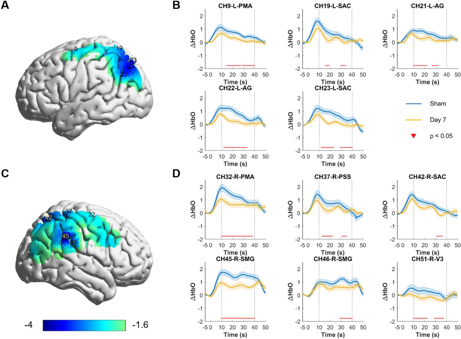 Topographic maps and HbO time courses showing reduced cortical activation after one week of repeated transcranial photobiomodulation