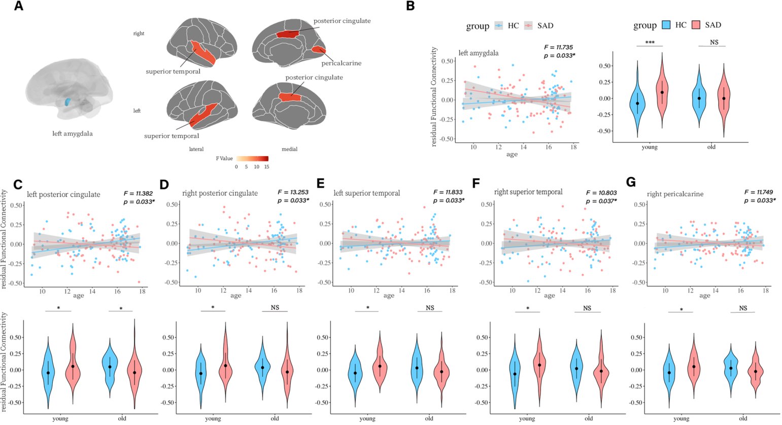 Brain regions and plots showing group-by-age interactions in right BNST functional connectivity during movie watching