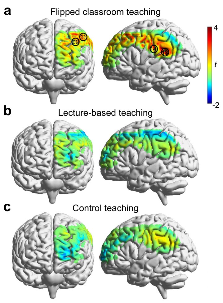 Cortical t-maps of teacher–student interbrain synchrony under flipped classroom, lecture-based and control teaching